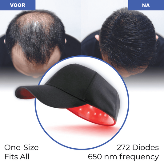 SerraPharma™ Red Light Therapy Cap